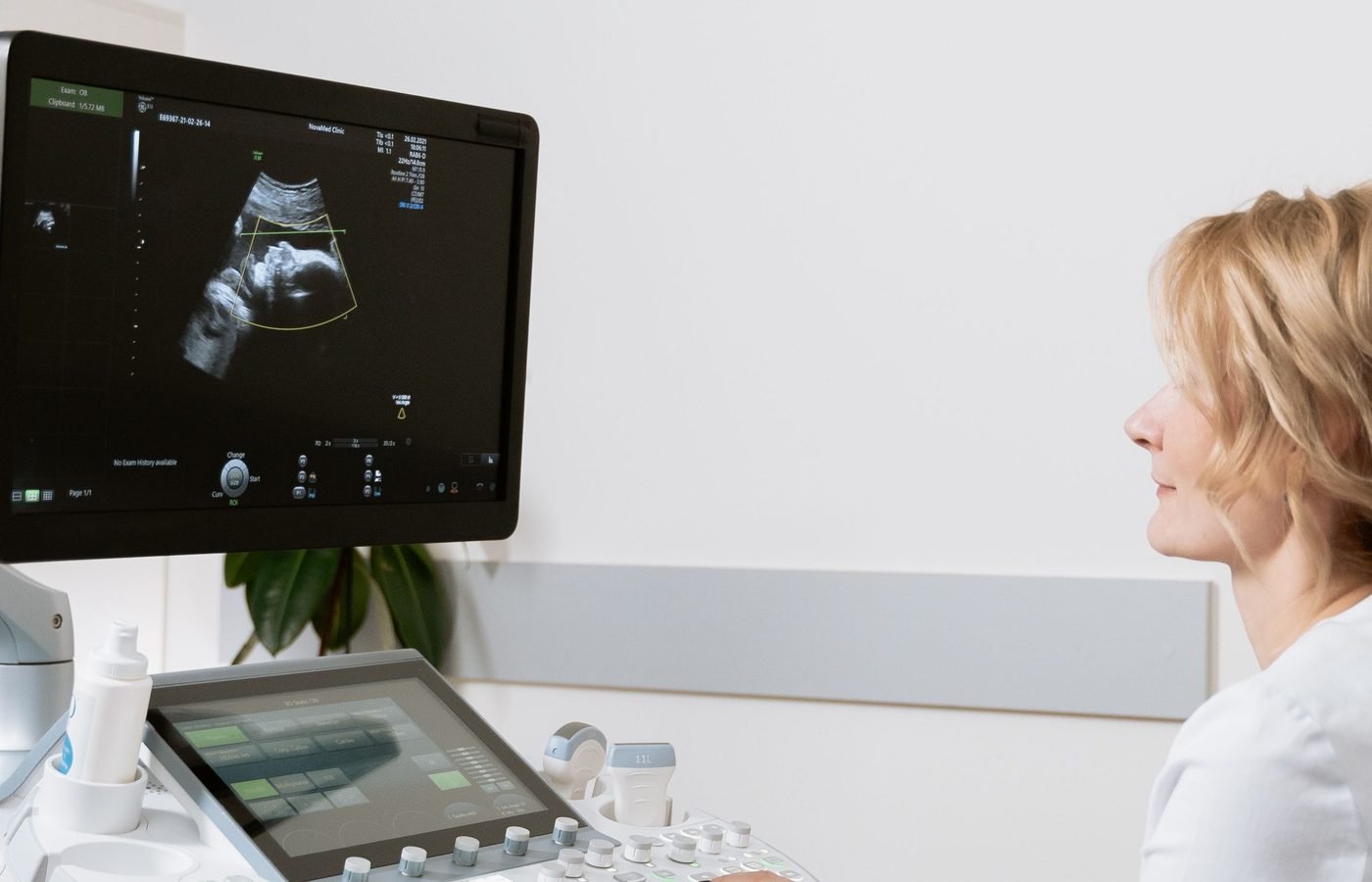 IUI service illustration